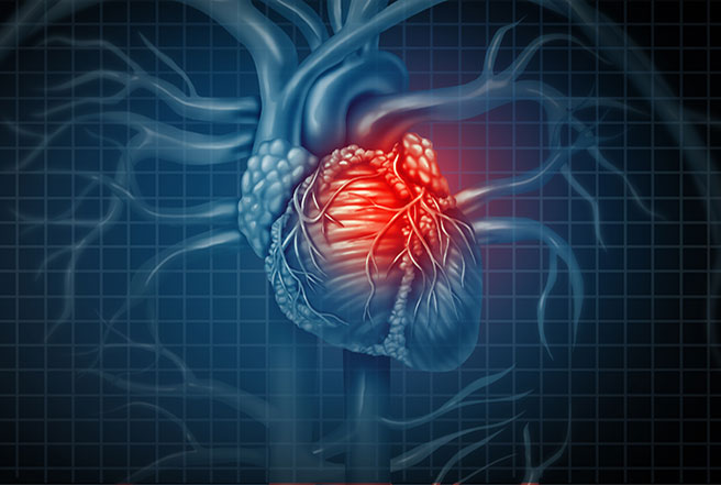 Infarctus du myocarde : améliorer la fonction cardiaque